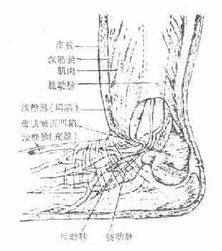 肱骨髁上骨折肱动、静脉压易引起缺血性挛缩