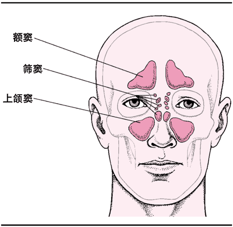 鼻窦炎