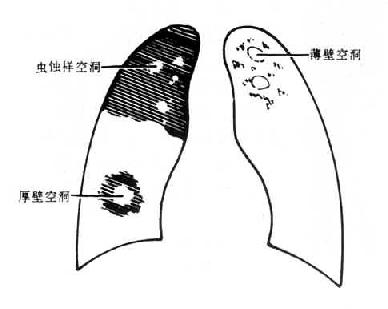 空洞的三种形态