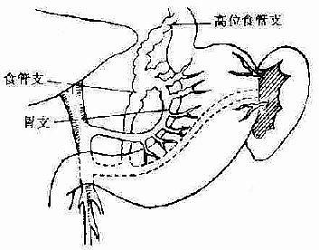 冠状静脉局部解剖示意图