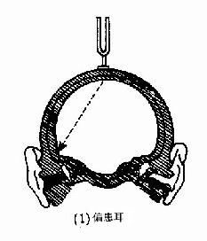 偏患耳