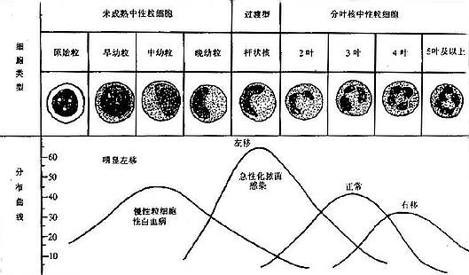 中性粒细胞的核象变化