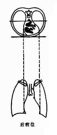 不同体位心、大血管结构投影示意图