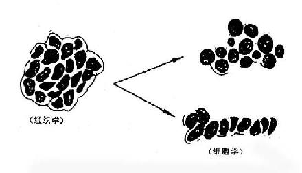 小细胞型未分化癌的组织学与细胞学