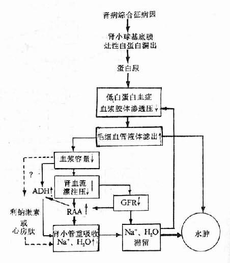 肾病性水肿发生机制示意图