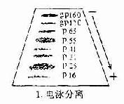 免疫印迹法检查患者血清中的HIV病毒抗体