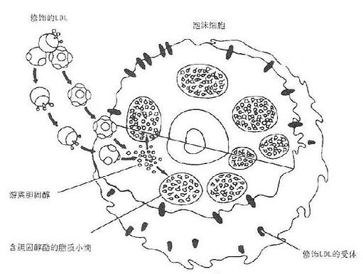 一、修饰的LDL与巨噬细胞泡沫化