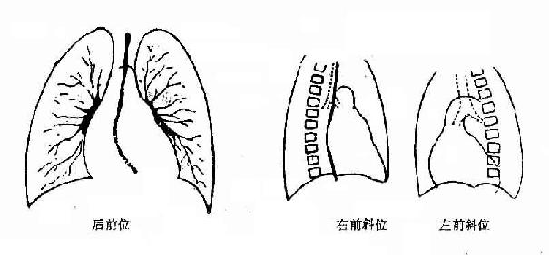 二尖瓣狭窄及关闭不全