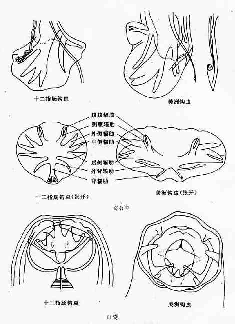 两种人体钩虫的口囊与交合伞