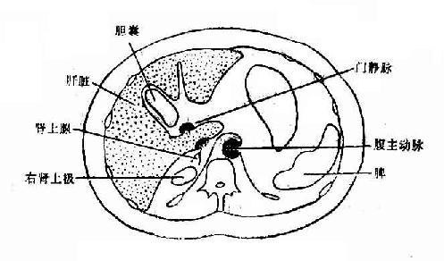 腹部横断层面图象