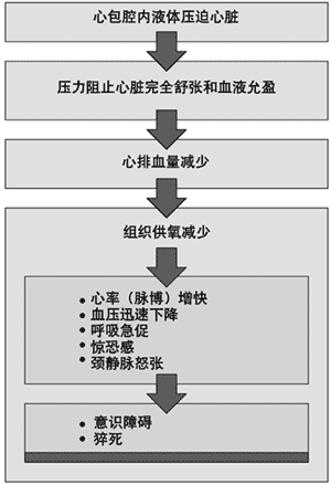 心脏填塞