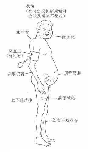 长期服用糖皮质激素后的不良反应示意图