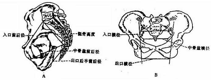 骨盆测量径线图