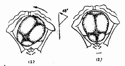胎头内旋转