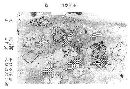 泡沫细胞透射电镜照片